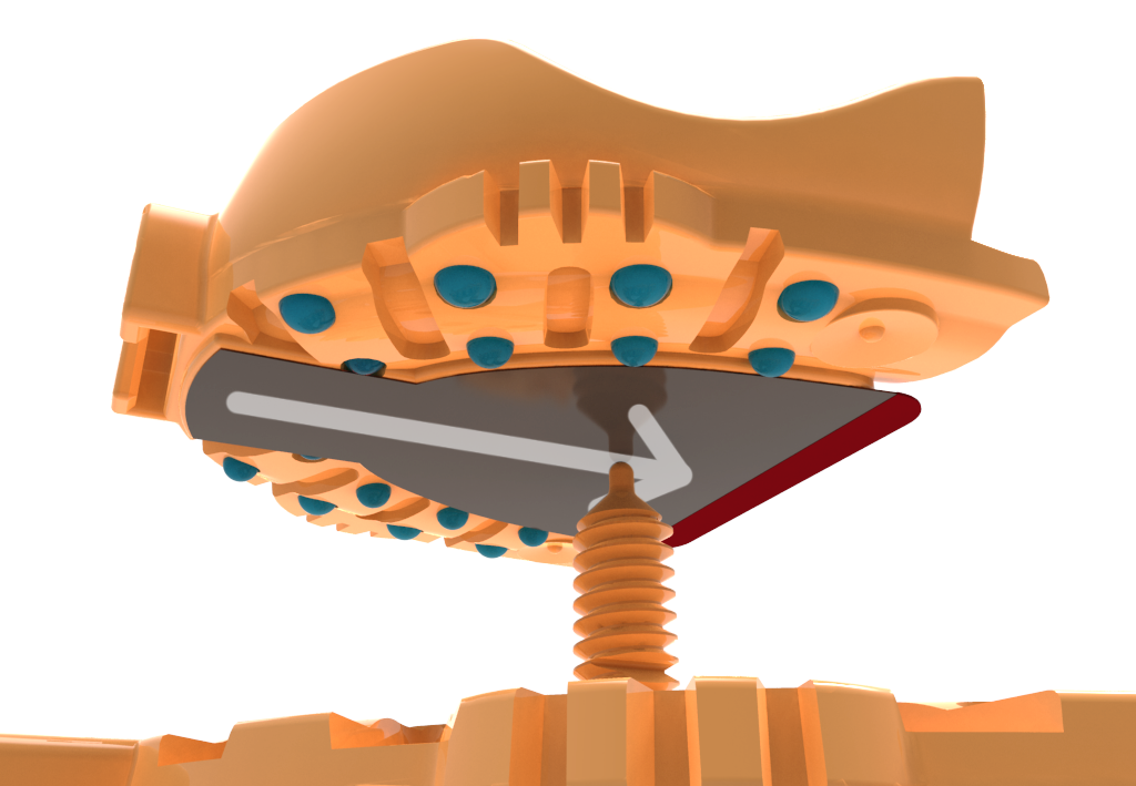 Peel, Place, Trace DENTCA’s New EZTracer™ Makes Centric Relations